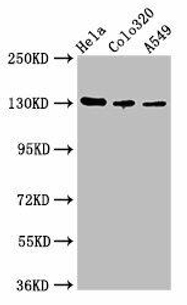 ITGAV Antibody (PACO54838)