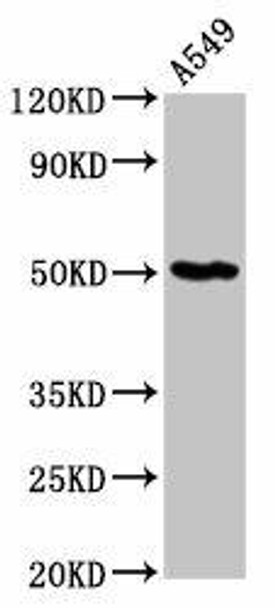 GDI1 Antibody (PACO55582)