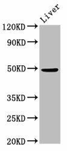 PPM1F Antibody (PACO55742)