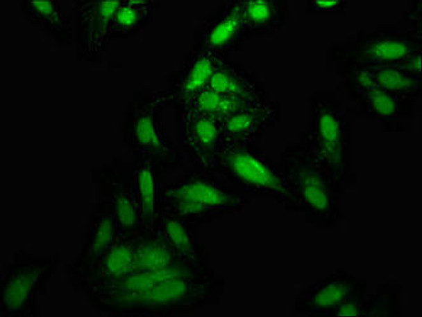 TOP1 Antibody (PACO55810)