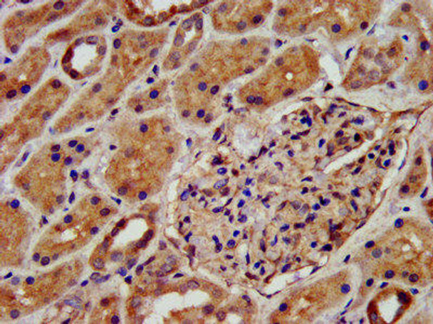 KCNJ8 Antibody (PACO57092)