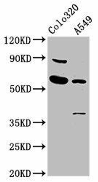 EBF3 Antibody (PACO57516)
