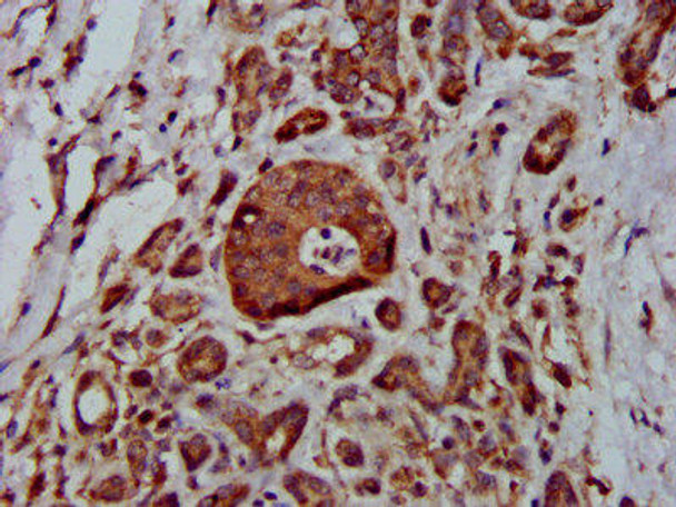 MTBP Antibody (PACO58436)