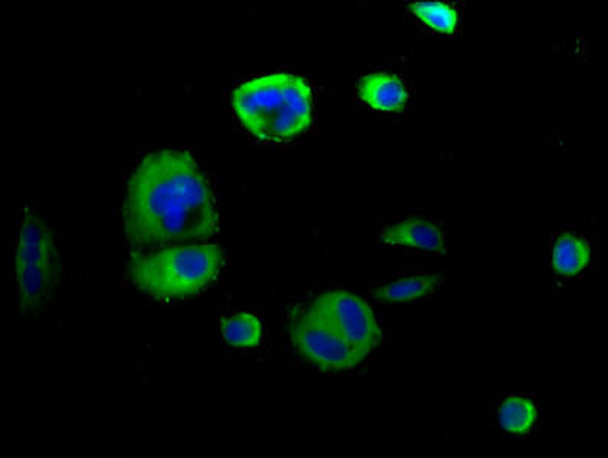 SEMA4D Antibody (PACO59269)