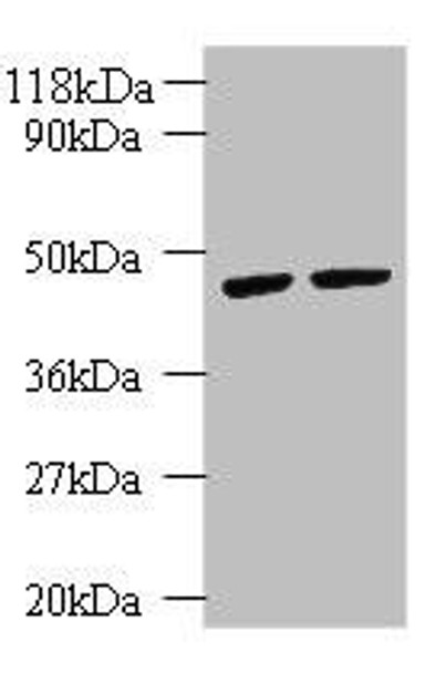 KRT18 Antibody (PACO32872)
