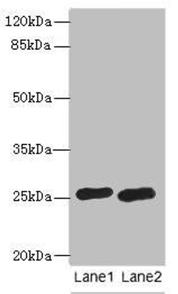 RAB20 Antibody (PACO41454)