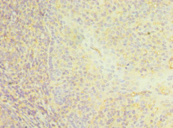 CD22 Antibody (PACO43163)