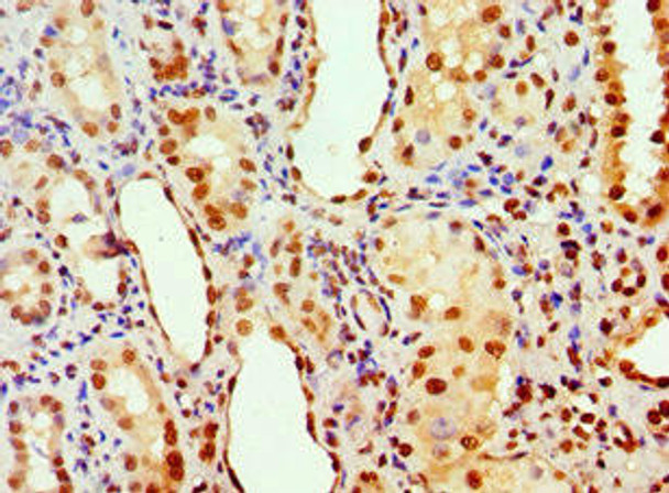 ANP32A Antibody (PACO43411)