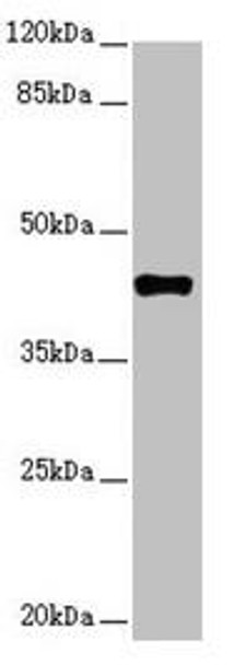 SH3GL1 Antibody (PACO44689)