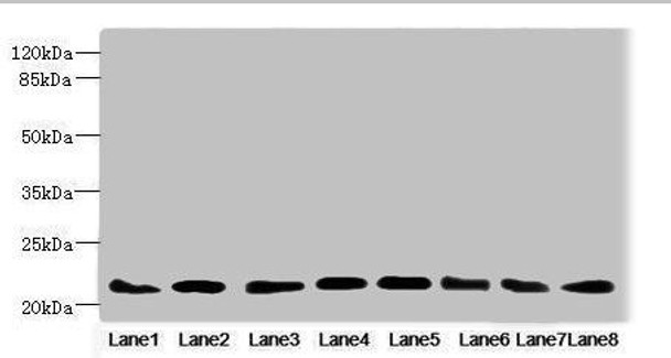 RAB23 Antibody (PACO44791)