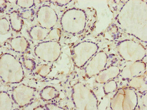 RNF11 Antibody (PACO45194)