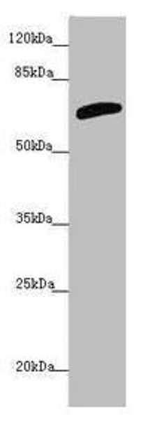 SLC6A12 Antibody (PACO45587)