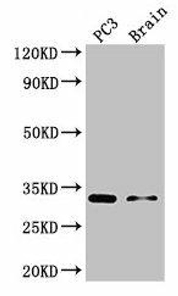 HOXB13 Antibody (PACO48698)