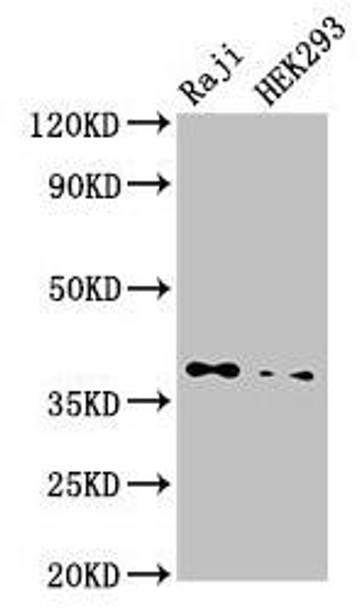 PPP1CB Antibody (PACO51838)