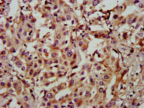 NAA60 Antibody (PACO58536)