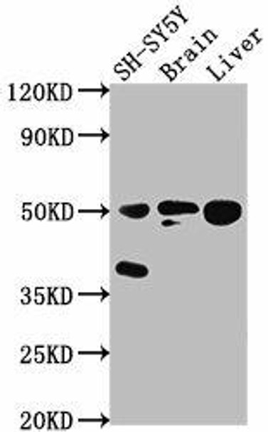 SEPT11 Antibody (PACO63999)