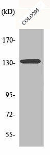 CARD11 Antibody (PACO00510)