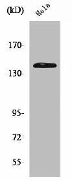 EIF2AK3 Antibody (PACO01317)