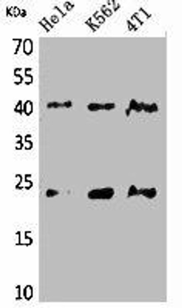 TMEM173 Antibody (PACO02163)