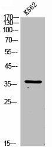 HSD11B1 Antibody (PACO02225)