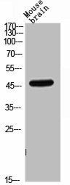 CD209 Antibody (PACO02266)