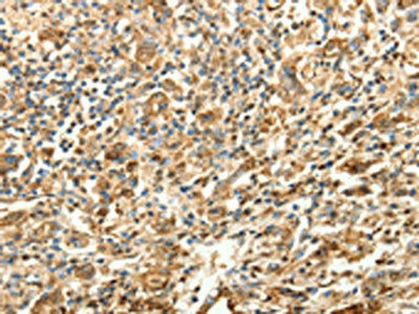 SLC25A11 Antibody (PACO14999)