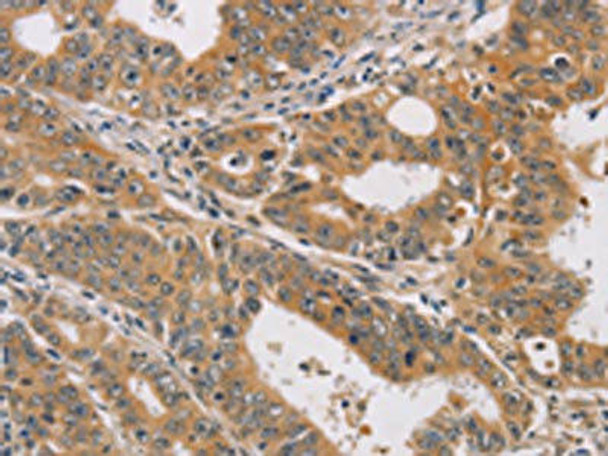 CDK11A/CDK11B Antibody (PACO19445)
