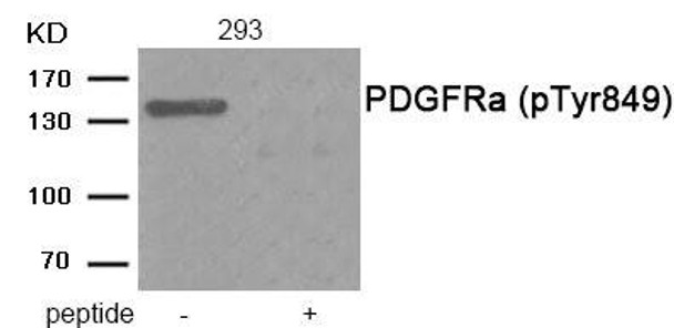 Phospho-PDGFRA (Tyr849) Antibody (PACO24008)