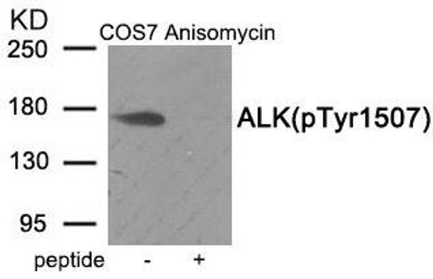 Phospho-ALK (Tyr1507) Antibody (PACO24052)