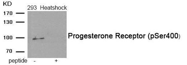 Phospho-PGR (Ser400) Antibody (PACO24075)