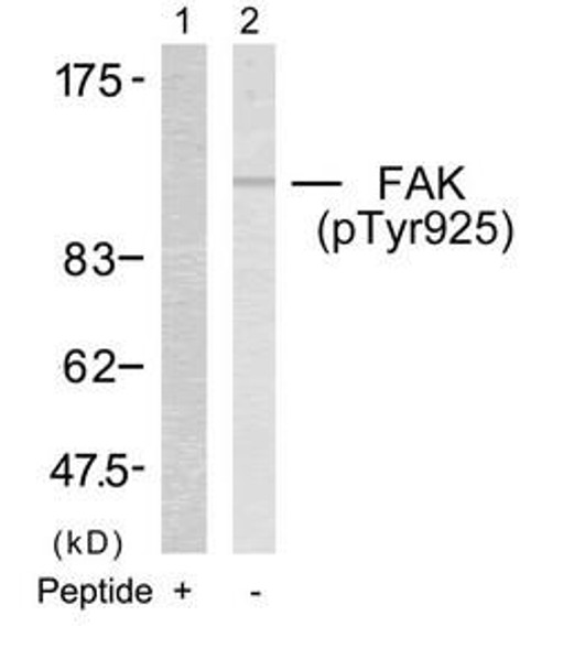 Phospho-PTK2 (Tyr925) Antibody (PACO24271)