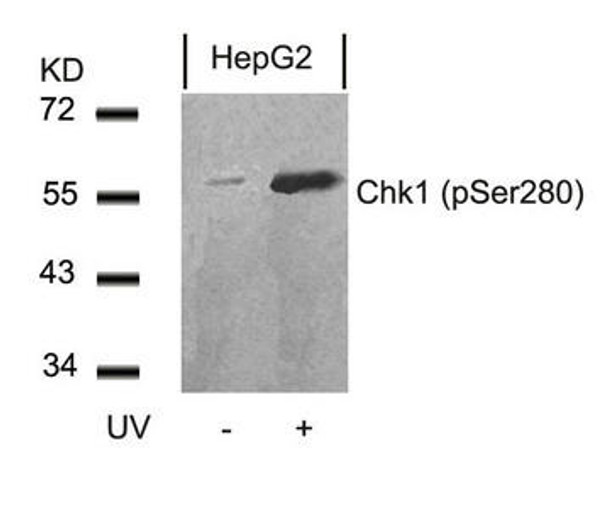 Phospho-CHEK1 (Ser280) Antibody (PACO24277)