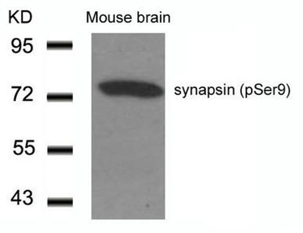 Phospho-SYN1 (Ser9) Antibody (PACO24317)