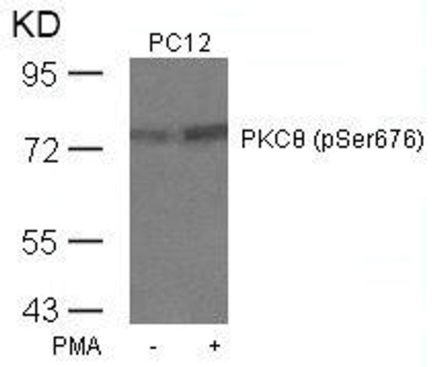 Phospho-PRKCQ (Ser676) Antibody (PACO24554)
