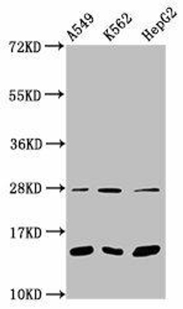 Mono-methyl-HIST1H2BC (K15) Antibody (PACO60497)