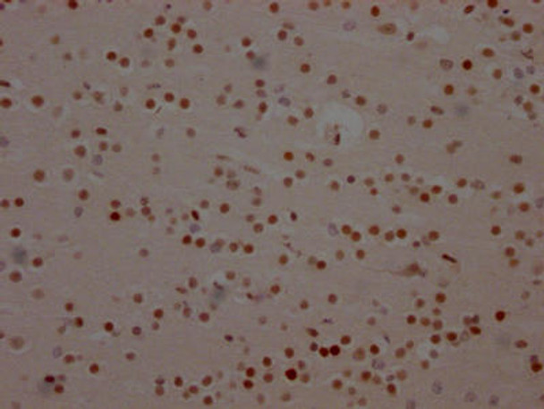 Anti-BRD4 Antibody (RACO0215)