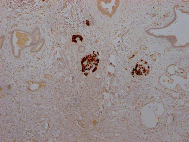 Anti-INS Antibody (RACO0216)