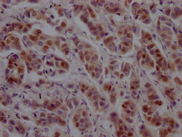 Anti-GATA3 Antibody (RACO0459)