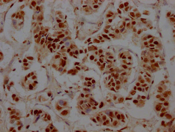 Anti-RBBP4 Antibody (RACO0471)