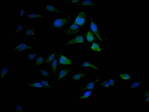 Anti-SAE1 Antibody (RACO0518)