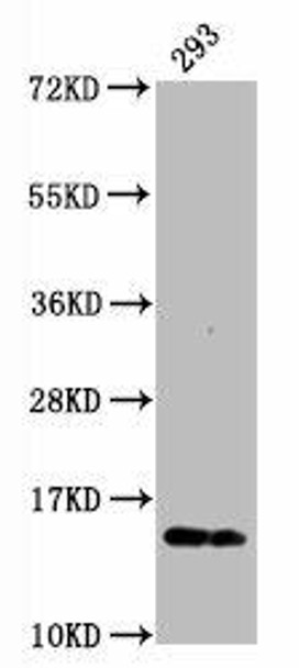 Anti-Phospho-Histone H2AX (S139) Antibody (RACO0012)