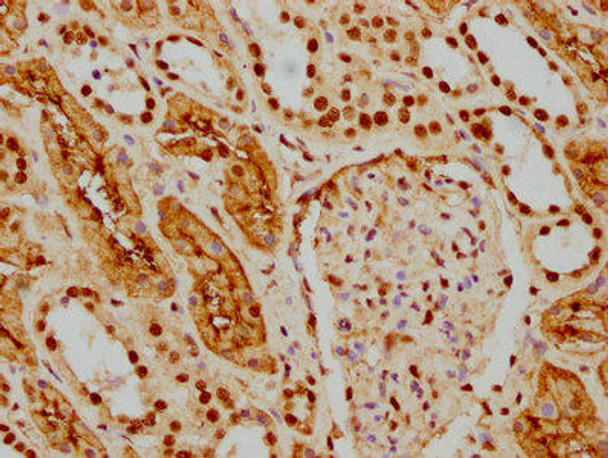 Anti-HDAC9 Antibody (RACO0135)