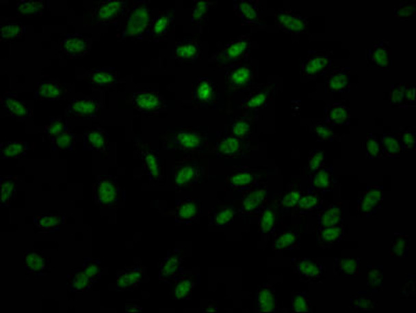 Anti-GZMB Antibody (RACO0331)