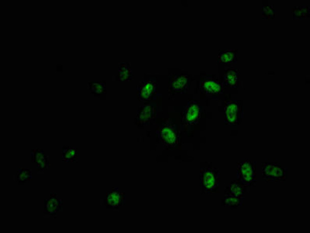 Anti-Phospho-MYB (S11) Antibody (RACO0051)