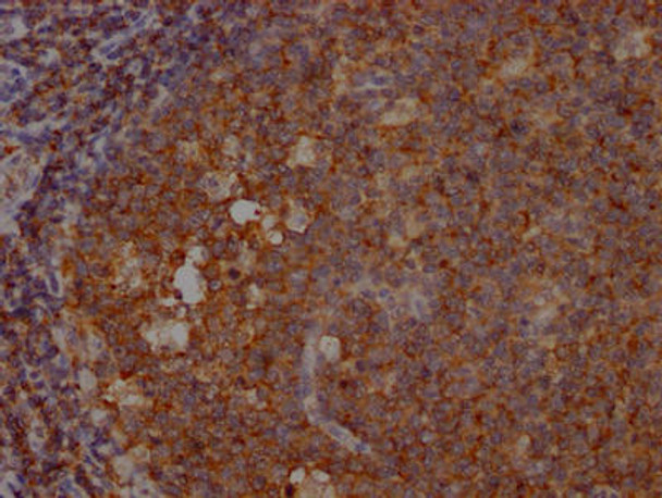 Anti-INPP5D Antibody (RACO0281)