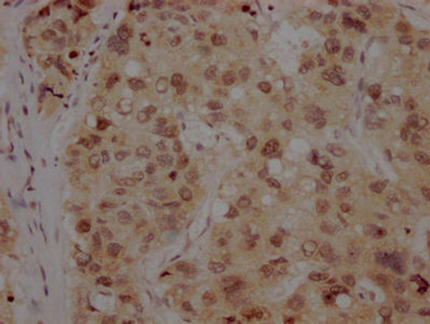 Anti-BMI1 Antibody (RACO0296)