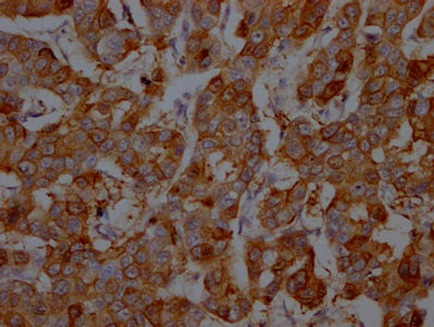 Anti-S100A9 Antibody (RACO0303)