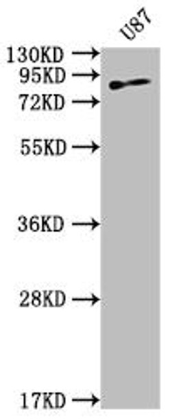 Anti-TGM2 Antibody (RACO0343)