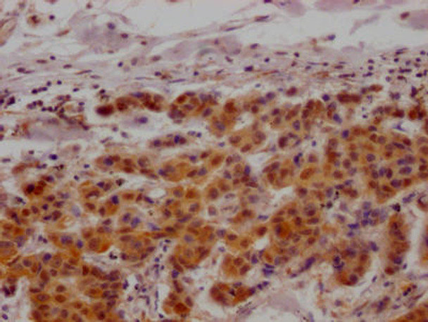 Anti-MAPKAPK2 Antibody (RACO0482)