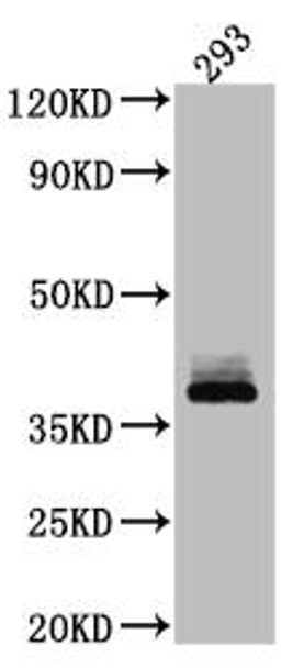 Anti-DKK1 Antibody (RACO0534)